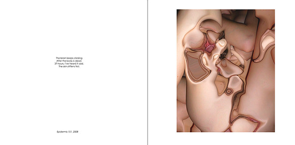 Epidermis-151